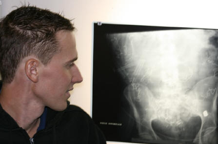 Paul de Waard bij een röntgenfoto waarop de kogel in zijn heup duidelijk te zien is.