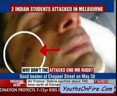 Op de Indiiase tv krijgen de aanslagen op de studenten in Australië veel aandacht.